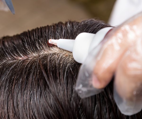 Coloration cheveux